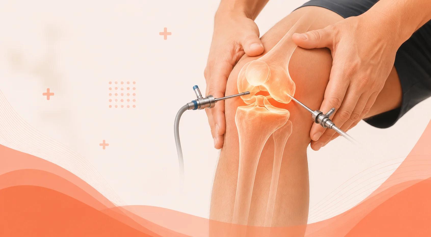 Arthroscopic knee surgery procedure performed by Dr R.P. Singh at Medinity Hospital Lucknow