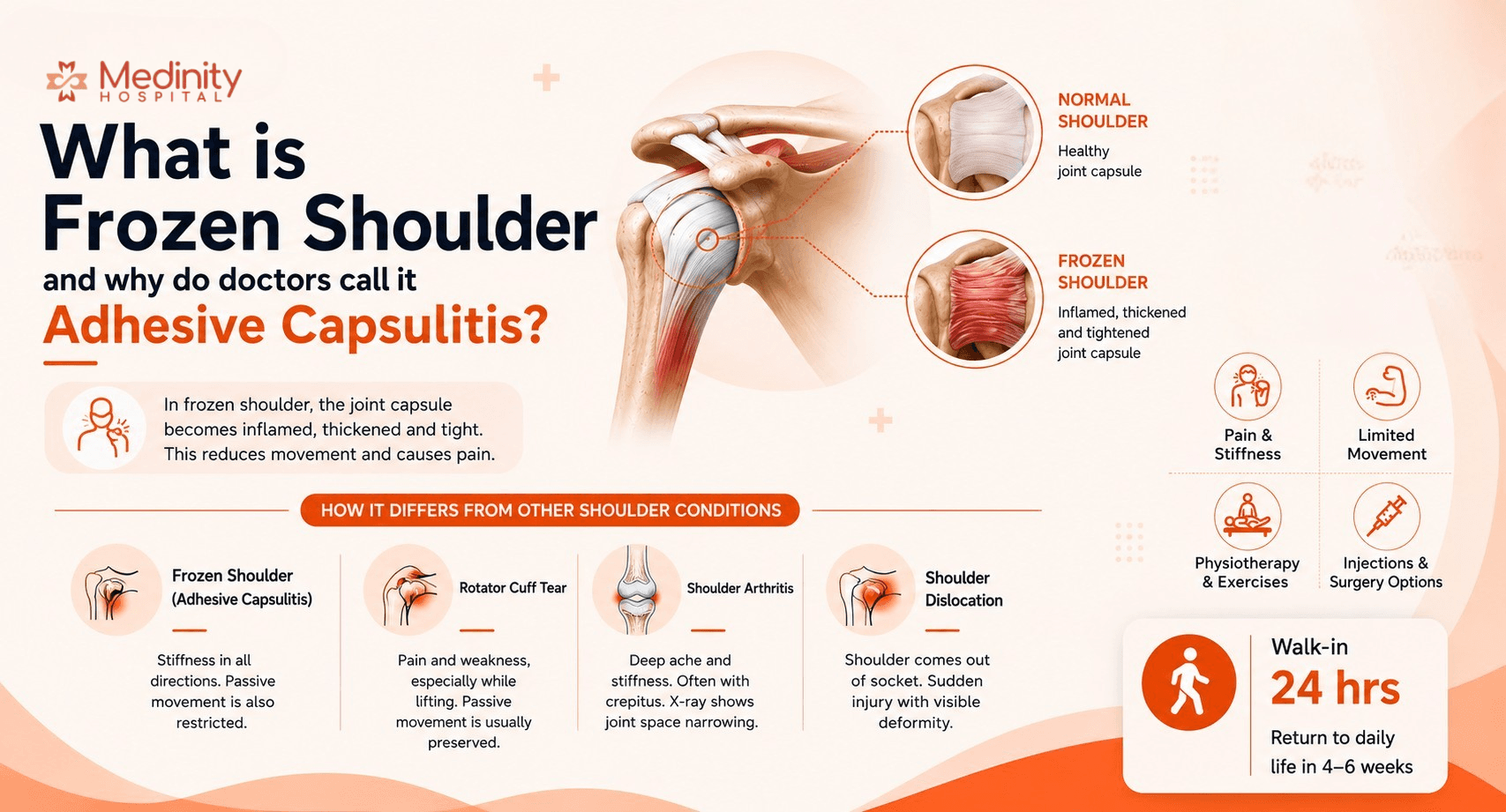 Adhesive capsulitis diagram Medinity Hospital Lucknow