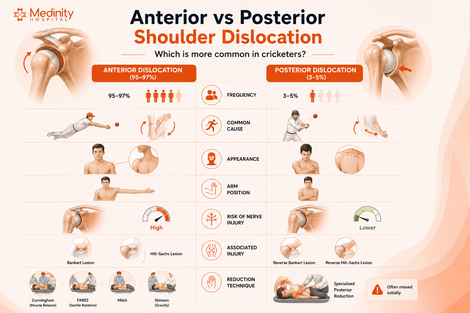 Anterior vs posterior shoulder dislocation comparison Medinity Hospital Lucknow