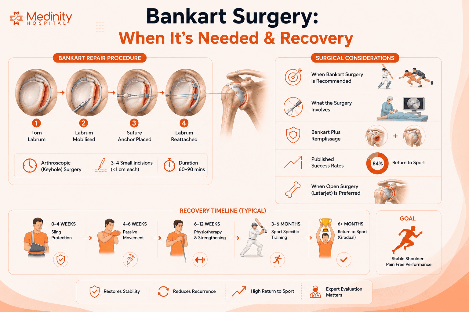 Bankart repair shoulder dislocation surgery procedure diagram Medinity Hospital Lucknow Dr R.P. Singh