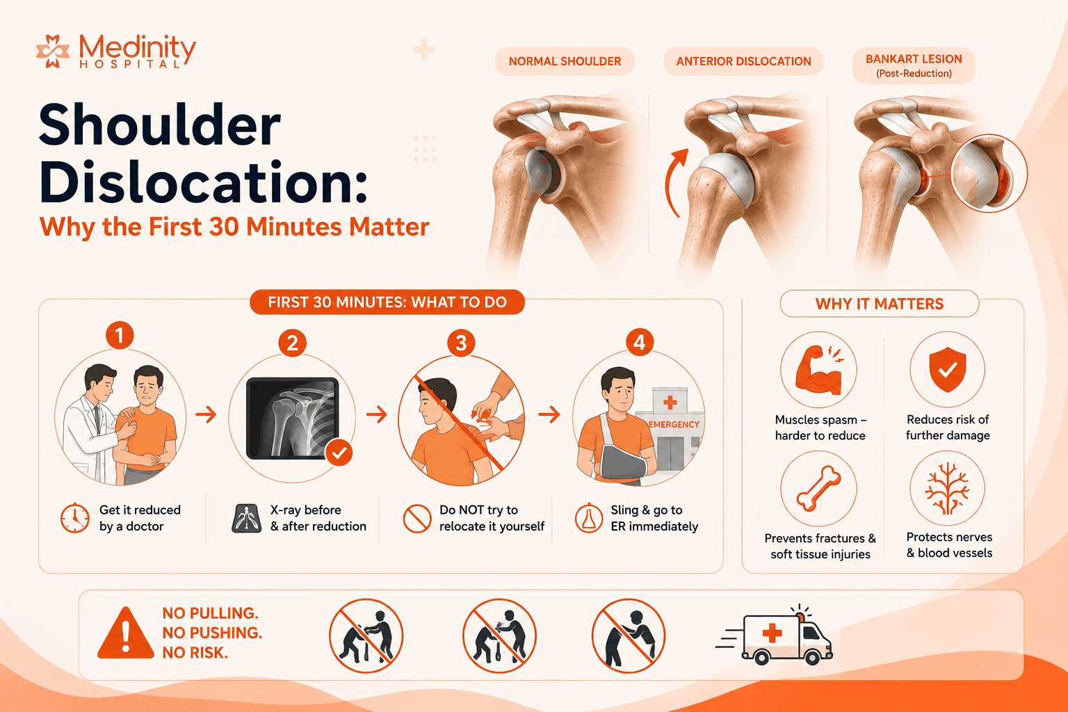 Shoulder dislocation anatomy and Bankart lesion diagram Medinity Hospital Lucknow