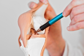 Ligament Repair